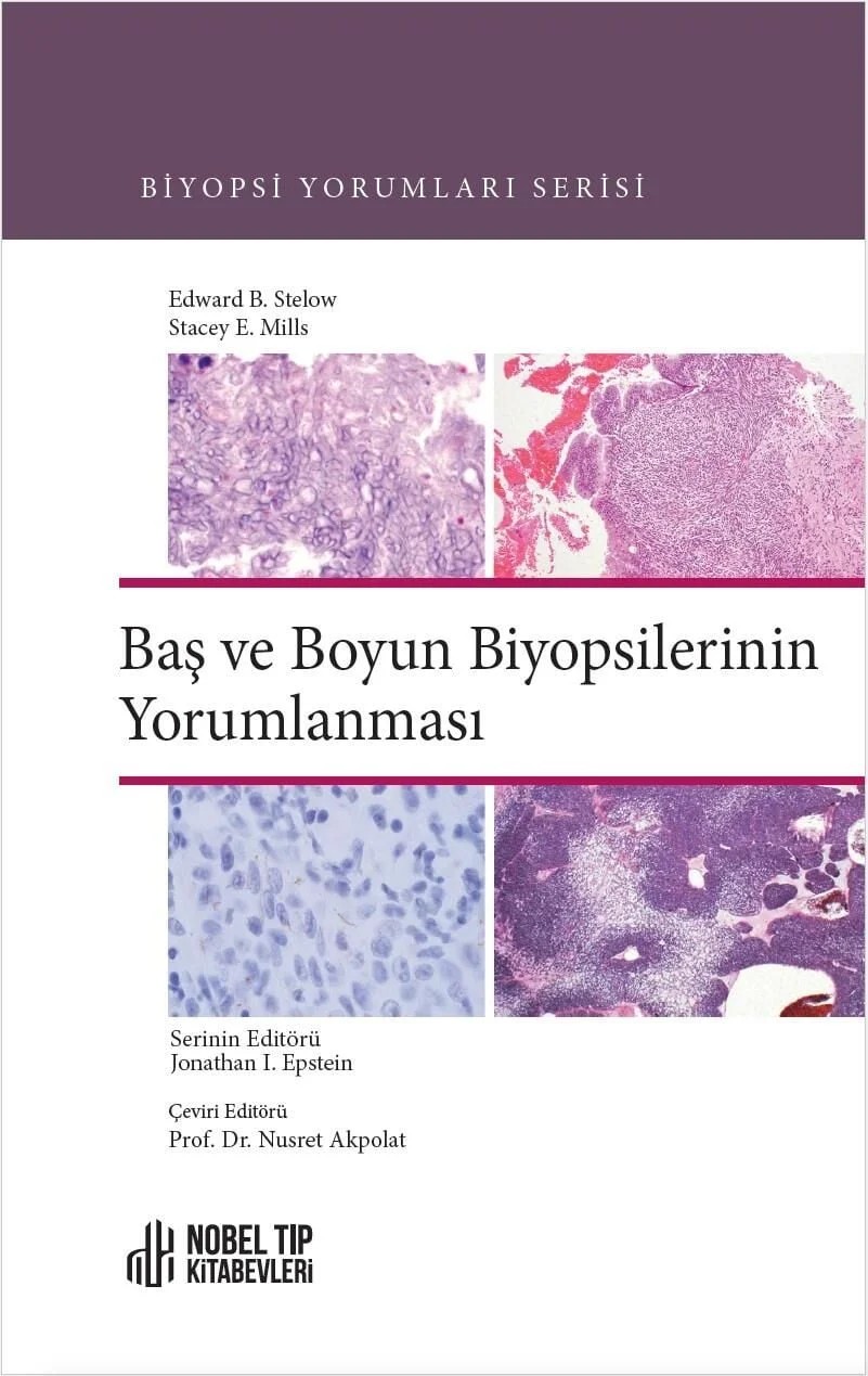 Baş ve Boyun Biyopsilerinin Yorumlanması – Edward B. Stelow, &nbsp, Stacey E. Mills – Nobel Tıp Kitabevleri kitap kapağı