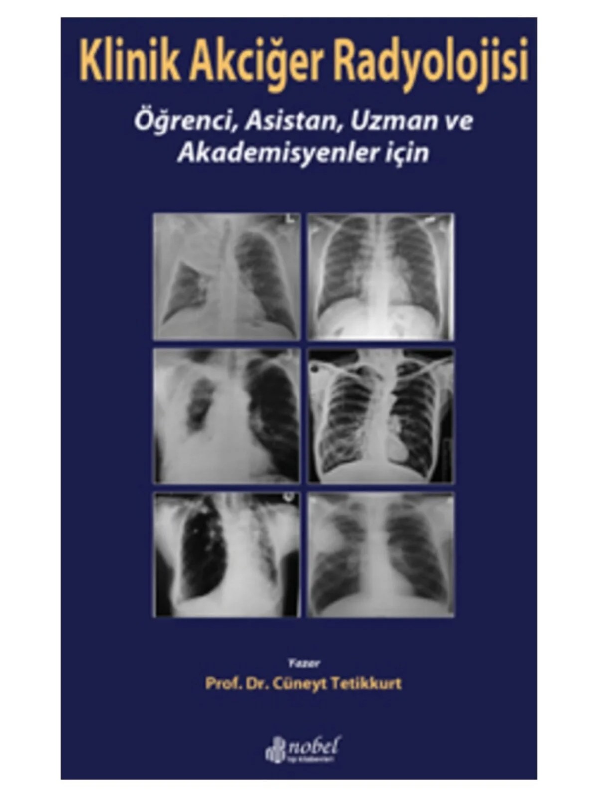 Klinik Akciğer Radyolojisi: Öğrenci, Asistan, Uzman ve Akademisyenler için – Prof. Dr. Cüneyt Tetikkurt – Nobel Tıp Kitabevleri kitap kapağı
