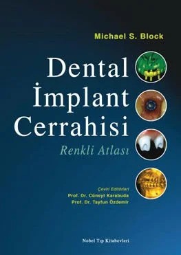 Dental İmplant Cerrahisi Renkli Atlası – Michael S. Block – Nobel Tıp Kitabevleri kitap kapağı