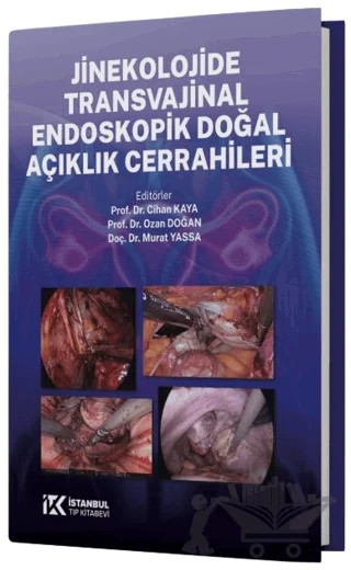 Jinekolojide Transvajinal Endoskopik Doğal Açıklık Cerrahileri – Cihan Kaya, Ozan Doğan, Murat Yassa – İstanbul Tıp Kitabevi kitap kapağı