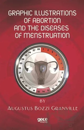 Graphic Illustrations Of Abortion And The Diseases Of Menstruation – Augustus Bozzi Granville – Gece Kitaplığı kitap kapağı