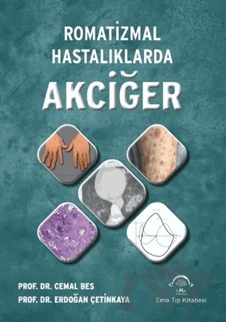 Romatizmal Hastalıklarda Akciğer – Cemal Bes, Erdoğan Çetinkaya – EMA Tıp Kitabevi kitap kapağı