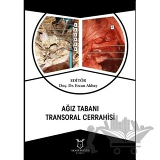 Ağız Tabanı Transoral Cerrahisi – Ercan Akbay – Akademisyen Kitabevi kitap kapağı
