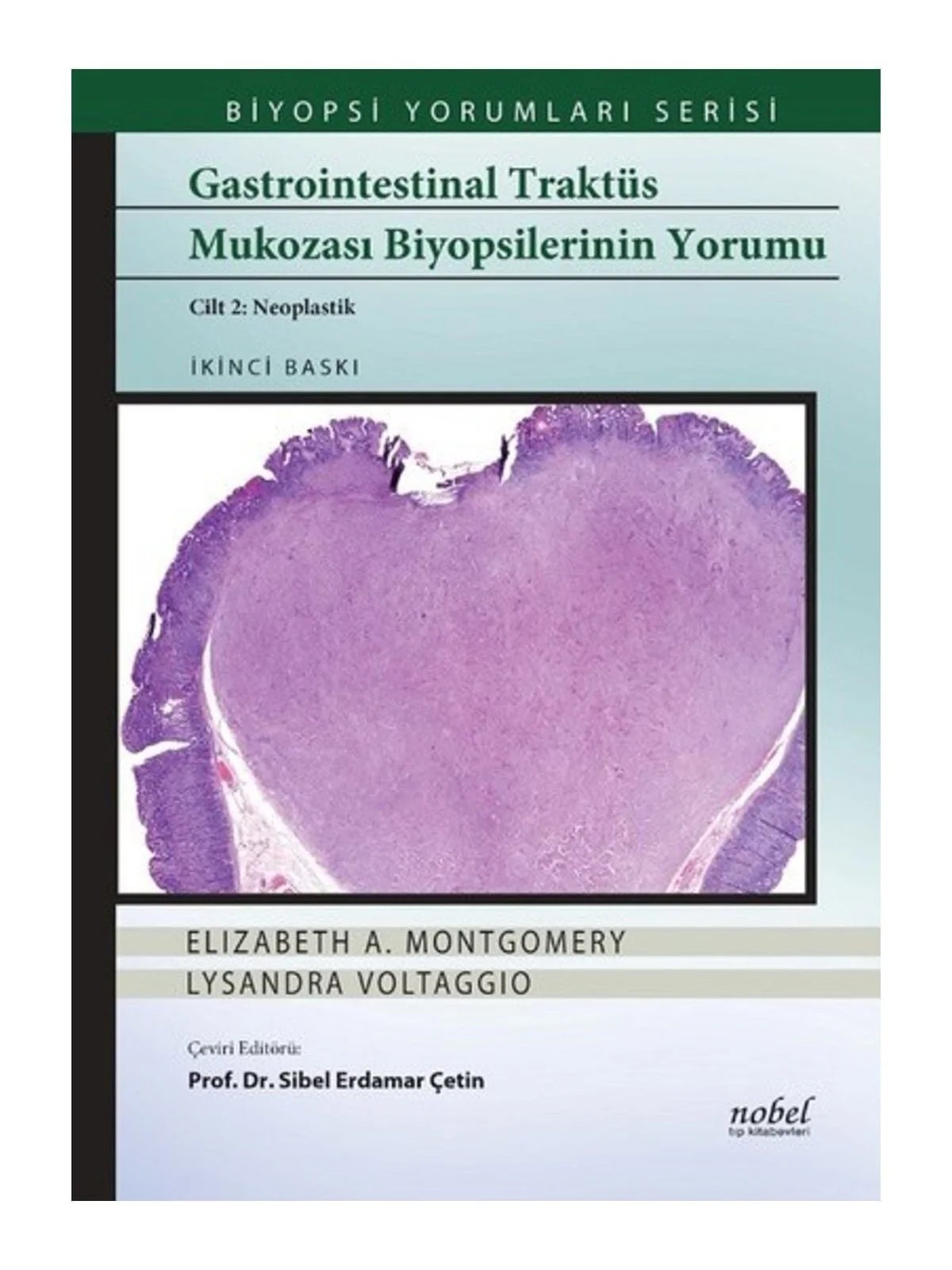 Gastrointestinal Traktüs Mukozası Biyopsilerinin Yorumu Cilt 2: Neoplastik - Biyopsi Yorumları Serisi – - – Nobel Tıp Kitabevleri kitap kapağı