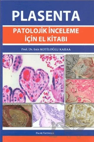 Plasenta Patolojik İnceleme İçin El Kitabı – Esin Kotiloğlu Karaa – Palme Yayıncılık kitap kapağı