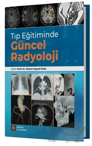 Tıp Eğitiminde Güncel Radyoloji – Ahmet Veysel Polat – İstanbul Tıp Kitabevi kitap kapağı