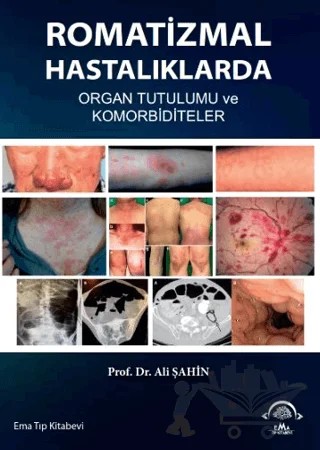 Romatizmal Hastalıklarda Organ Tutulumu ve Komorbiditeler – Ali Şahin – EMA Tıp Kitabevi kitap kapağı