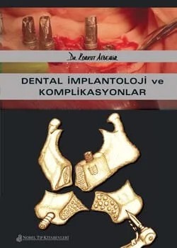 Dental İmplantoloji ve Komplikasyonlar – Dr. Korkut Aldemir – Nobel Tıp Kitabevleri kitap kapağı