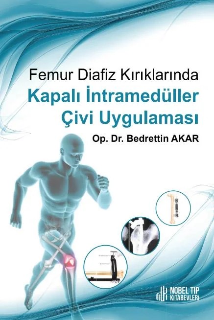 Femur Diafiz Kırıklarında Kapalı İntramedüller Çivi Uygulaması – Nobel Tıp Kitabevleri kitap kapağı
