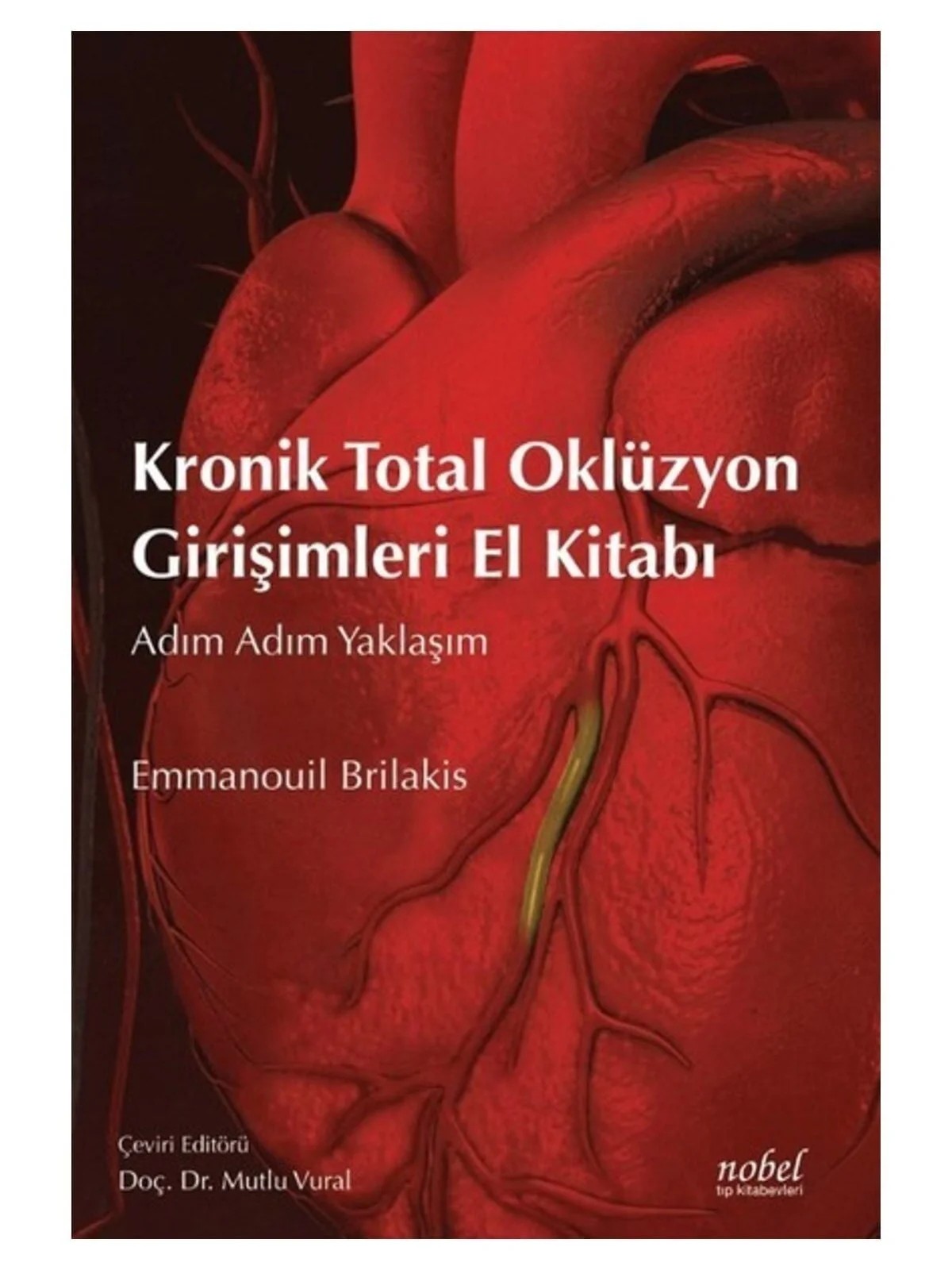Kronik Total Oklüzyon Girişimleri El Kitabı: Adım Adım Yaklaşım – - – Nobel Tıp Kitabevleri kitap kapağı