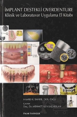 İmplant Destekli Overdenture – Hamid R. Shafie – Palme Yayıncılık kitap kapağı