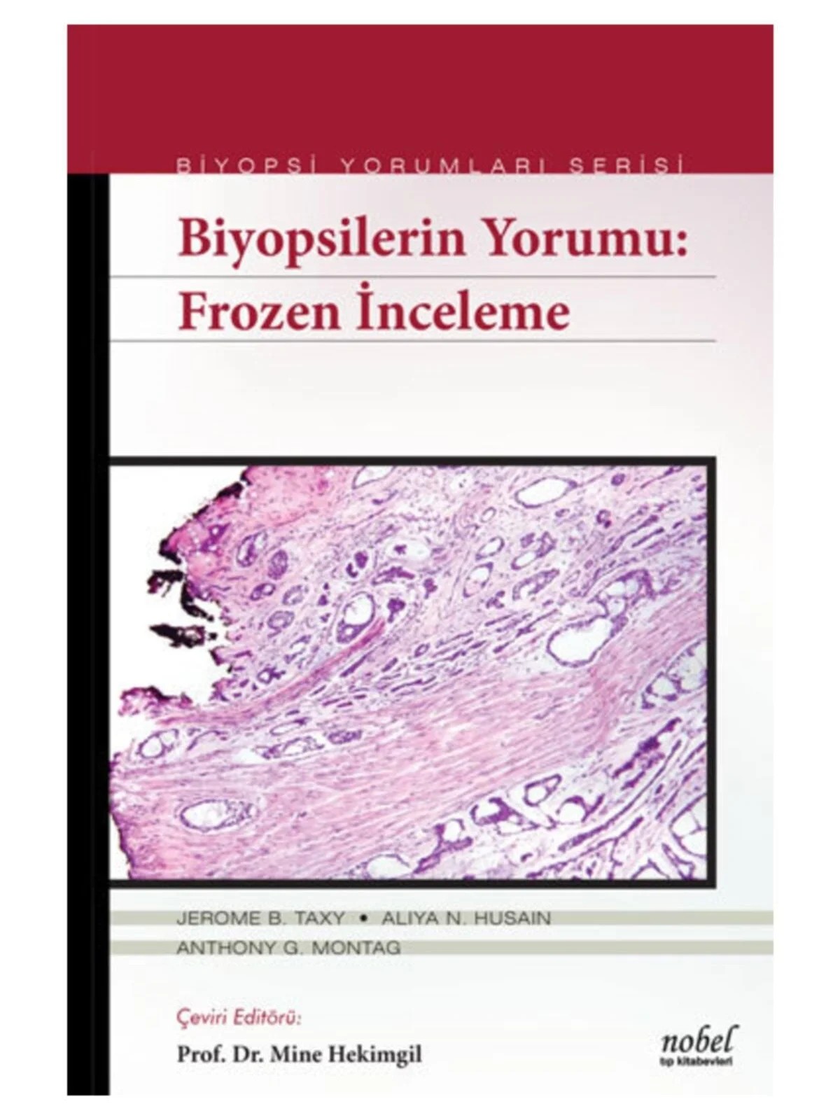 Biyopsilerin Yorumu: Frozen İnceleme - Biyopsi Yorumları Serisi – Taxy, &nbsp, Husain, Montag – Nobel Tıp Kitabevleri kitap kapağı