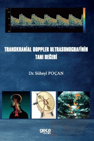 Transkranial Doppler Ultrasonografinin Tanı Değeri – Süheyl Poçan – Gece Kitaplığı kitap kapağı