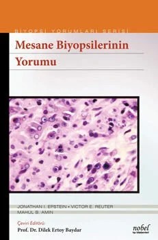 Mesane Biyopsilerinin Yorumu - Biyopsi Yorumları Serisi – Epstein,  , Reuter, Amin – Nobel Tıp Kitabevleri kitap kapağı