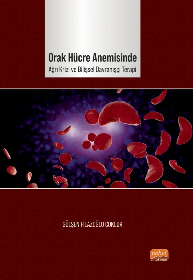 Orak Hücre Anemisinde Ağrı Krizi ve Bilişsel Davranışçı Terapi – Gülşen Filazoğlu Çokluk – Nobel Bilimsel Eserler kitap kapağı