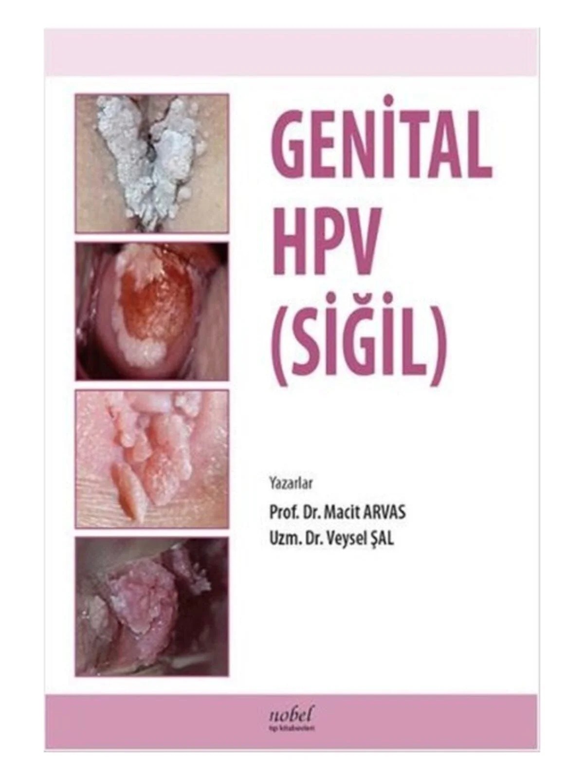 Genital HPV (SİĞİL) – Prof. Dr. Macit Arvas, &nbsp, Uzm. Dr. Veysel Şal – Nobel Tıp Kitabevleri kitap kapağı