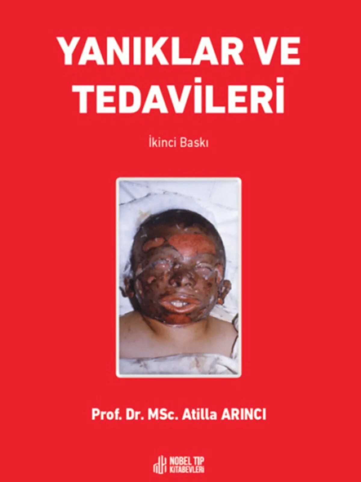 Yanıklar ve Tedavileri – - – Nobel Tıp Kitabevleri kitap kapağı