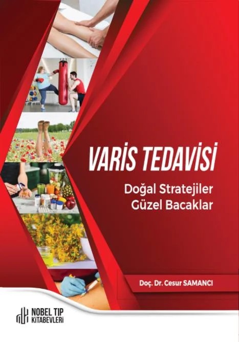 Varis Tedavisi Doğal Stratejiler,Güzel Bacaklar – Nobel Tıp Kitabevleri kitap kapağı
