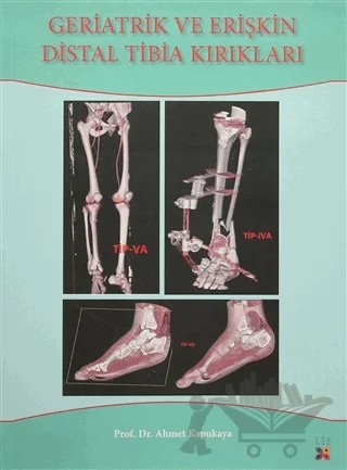 Geriatrik Ve Erişkin Distal Tibia Kırıkları – Ahmet Kapukaya – Lis Basın Yayın kitap kapağı