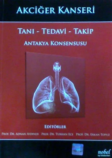 Akciğer Kanseri: Tanı - Tedavi - Takip - Antakya Konsensusu – - – Nobel Tıp Kitabevleri kitap kapağı