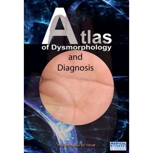 Atlas Of Dysmorphology And Diagnosis – Munis Dündar – Medical Kitabevi kitap kapağı