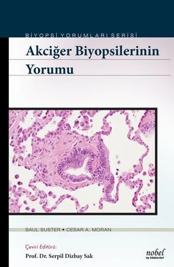 Akciğer Biyopsilerinin Yorumu - Biyopsi Yorumları Serisi – Suster, &nbsp, Moran – Nobel Tıp Kitabevleri kitap kapağı
