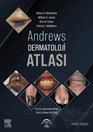 Andrews Dermatoloji Atlası – Robert G. Micheletti, William D. James, Dirk M. Elston, Patrick J. McMahon – EMA Tıp Kitabevi kitap kapağı