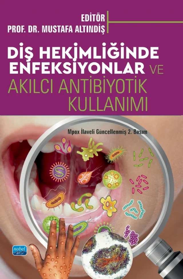 Diş Hekimliğinde Enfeksiyonlar ve Akılcı Antibiyotik Kullanımı – Doğukan Yılmaz, Ebru Sağlam, Elif Gül Aydın, Emre Bodrumlu, Ertuğrul Güçlü, Görkem Tekin, Gülçin Akca, Hakan Özdemir, Hanife Altınışık, Merve Tekelioğlu, Mustafa Altındiş, Nasibe Aycan Yılmaz, Neslihan Yılmaz, Nesrin Saruhan, Nuray Tüloğlu, Pelin Tanyeri, Seçil Çubuk, Selma Altındiş, Şule Bayrak – Nobel Akademik Yayıncılık kitap kapağı