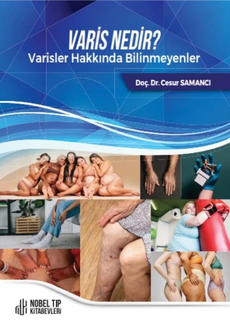 Varis Nedir ? Varisler Hakkında Bilinmeyenler – Nobel Tıp Kitabevleri kitap kapağı