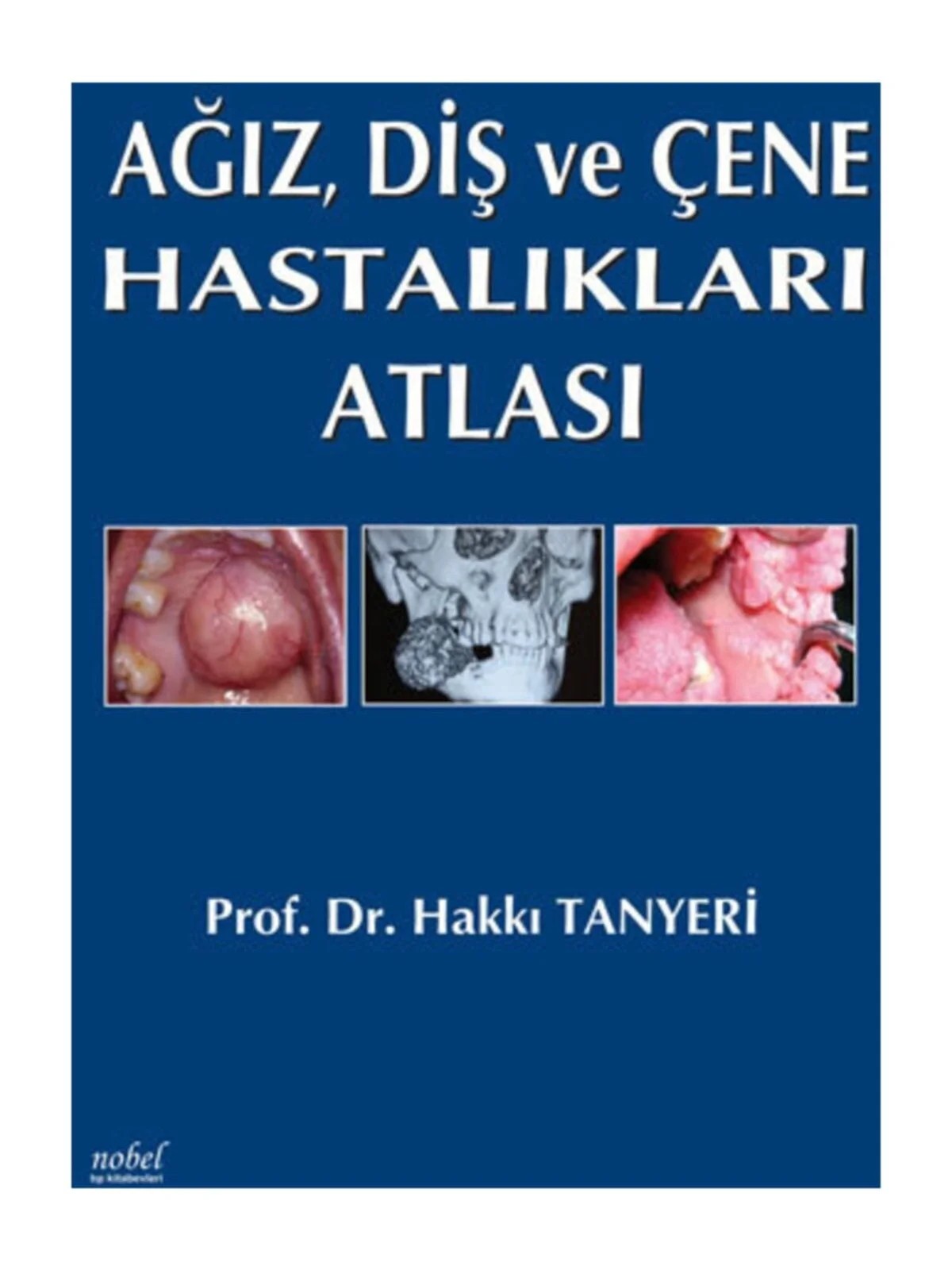 Ağız, Diş ve Çene Hastalıkları Atlası – Prof. Dr. Hakkı Tanyeri – Nobel Tıp Kitabevleri kitap kapağı