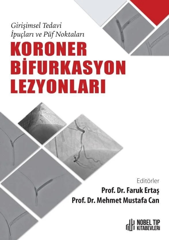 Koroner Bifurkasyon Lezyonları: Girişimsel Tedavi İpuçları ve Püf Noktaları – Nobel Tıp Kitabevleri kitap kapağı