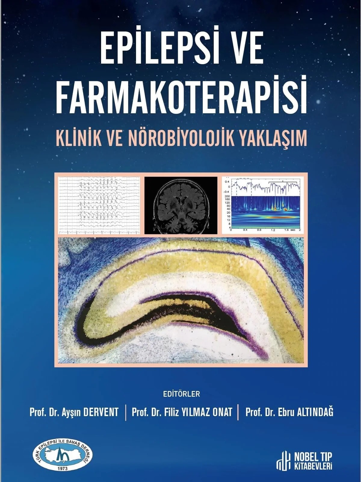 Epilepsi ve Farmakoterapisi Klinik ve Nörobiyolojik Yaklaşım – - – Nobel Tıp Kitabevleri kitap kapağı