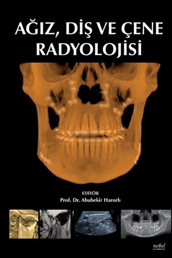 Ağız, Diş ve Çene Radyolojisi – - – Nobel Tıp Kitabevleri kitap kapağı