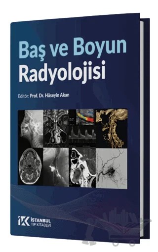 Baş ve Boyun Radyolojisi – Hüseyin Akan – İstanbul Tıp Kitabevi kitap kapağı