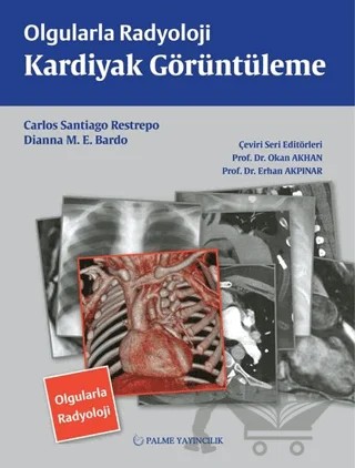 Olgularla Radyoloji Kardiyak Görüntüleme – Carlos Santiago Restrepo, Dianna M. E. Bardo – Palme Yayıncılık kitap kapağı