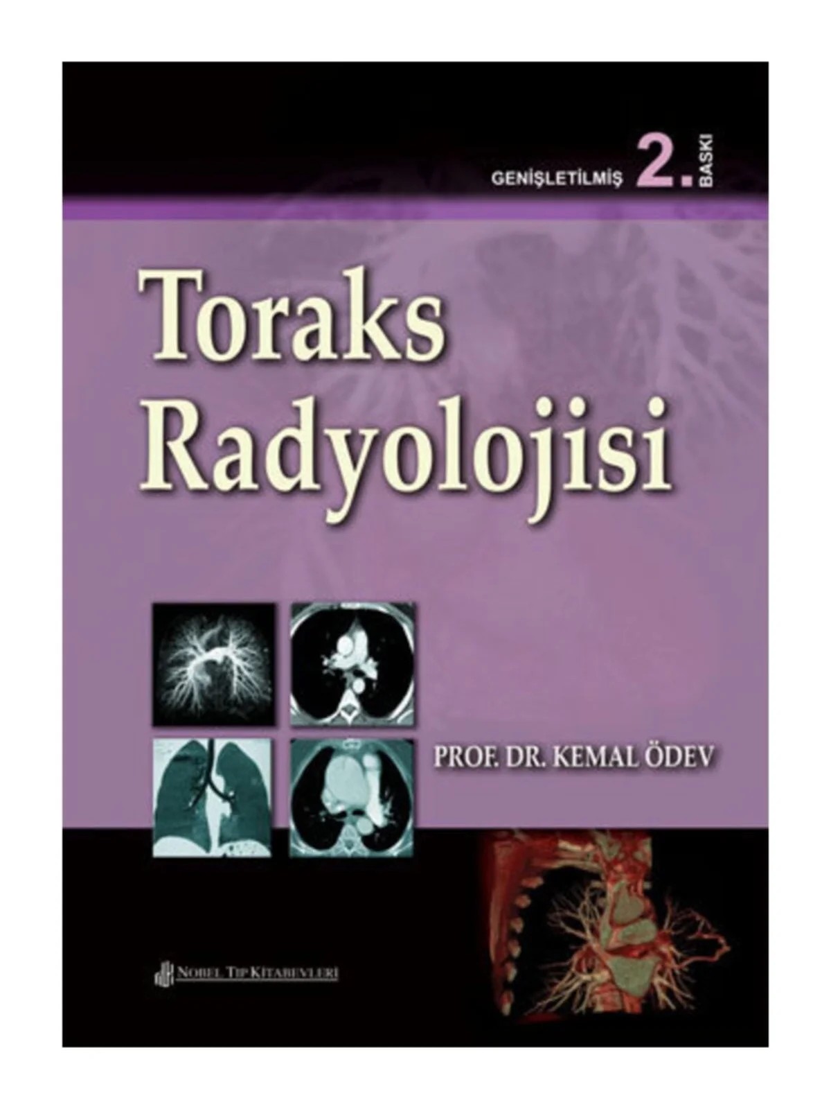 Toraks Radyolojisi ( 2.Baskı ) – Prof. Dr. Kemal Ödev – Nobel Tıp Kitabevleri kitap kapağı