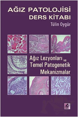 Ağız Patolojisi Ders Kitabı – Tülin Oygür – Efil Yayınevi kitap kapağı