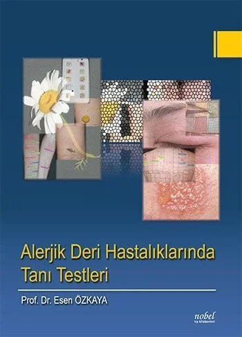 Alerjik Deri Hastalıklarında Tanı Testleri – Prof. Dr. Esen Özkaya – Nobel Tıp Kitabevleri kitap kapağı