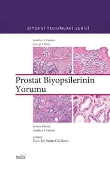 Prostat Biyopsilerinin Yorumu - Biyopsi Yorumları Serisi – Epstein,  , Netto – Nobel Tıp Kitabevleri kitap kapağı