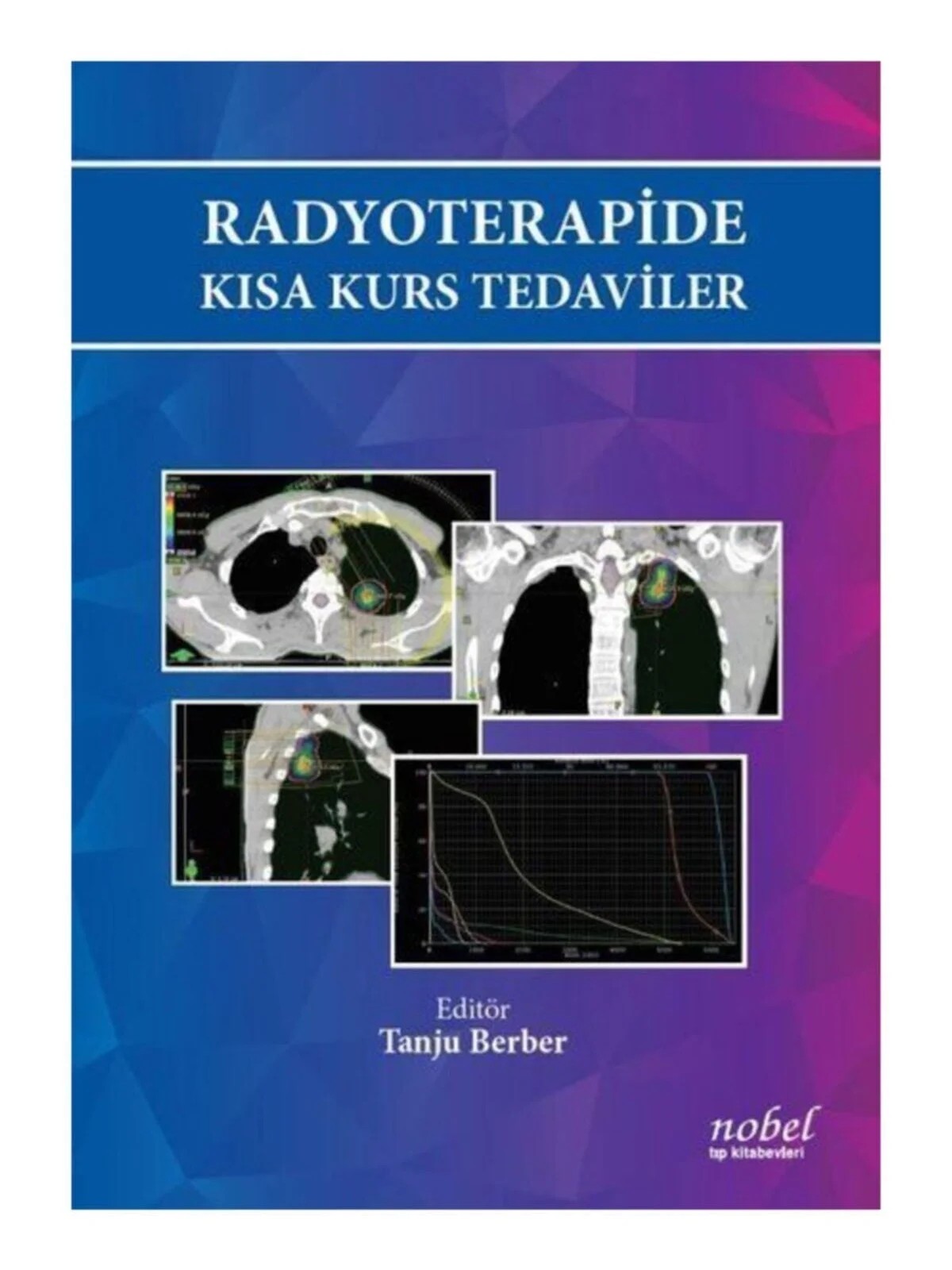 Radyoterapide Kısa Kurs Tedaviler – - – Nobel Tıp Kitabevleri kitap kapağı