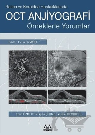 Retina ve Koroidea Hastalıklarında OCT Anjiyografi – Emin Özmert, Figen Şermet, Sibel Demirel – Arkadaş Yayınları kitap kapağı