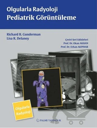 Olgularla Radyoloji Pediatrik Görüntüleme – Lisa R. Delaney, Richard B. Gunderman – Palme Yayıncılık kitap kapağı