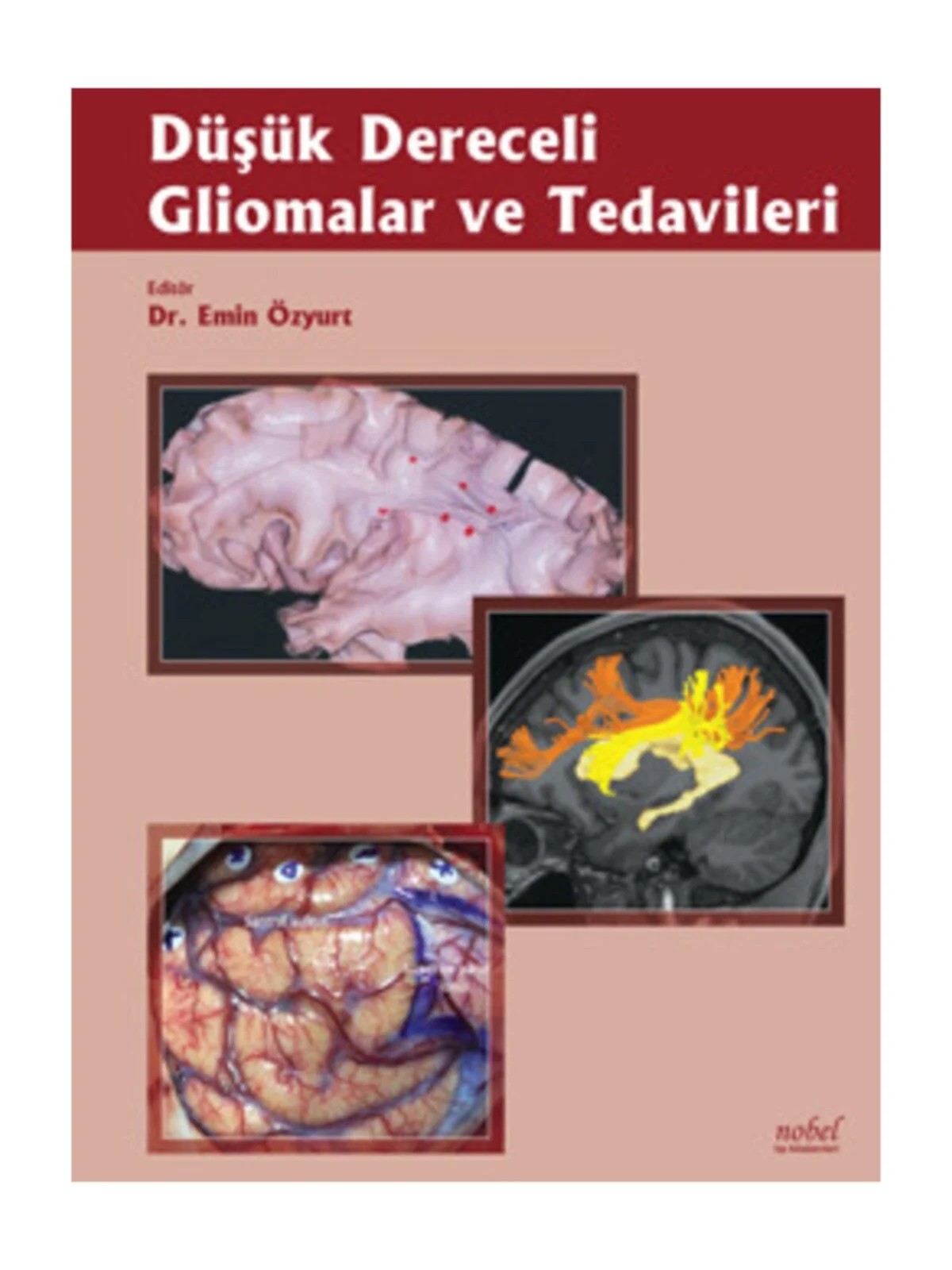 Düşük Dereceli Gliomalar ve Tedavileri – - – Nobel Tıp Kitabevleri kitap kapağı