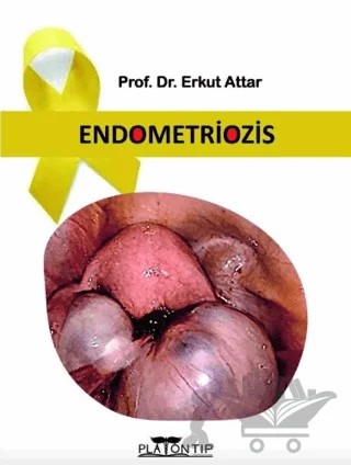 Endometriozis – Erkut Attar – Platon Hukuk kitap kapağı
