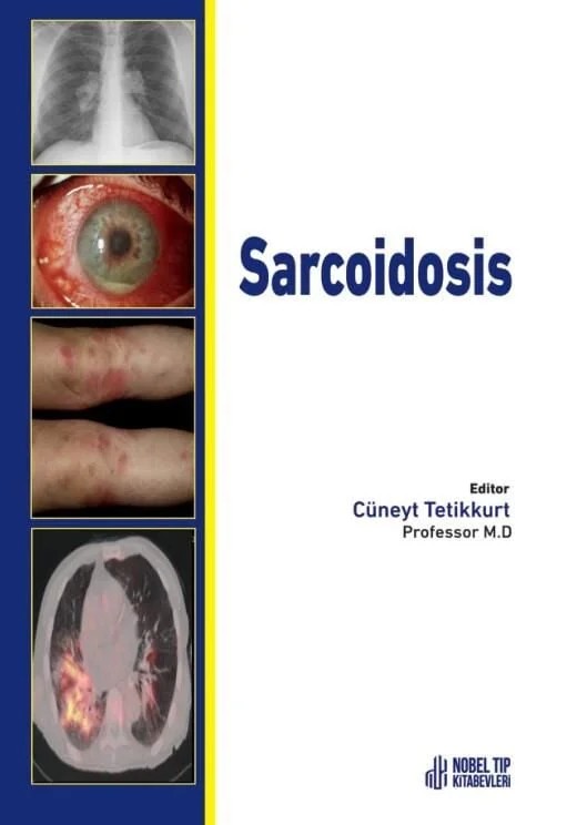 Sarcoidosis – Nobel Tıp Kitabevleri kitap kapağı