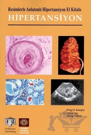 Resimlerle Anlatımlı Hipertansiyon El Kitabı – Peter Semple – İstanbul Tıp Kitabevi kitap kapağı