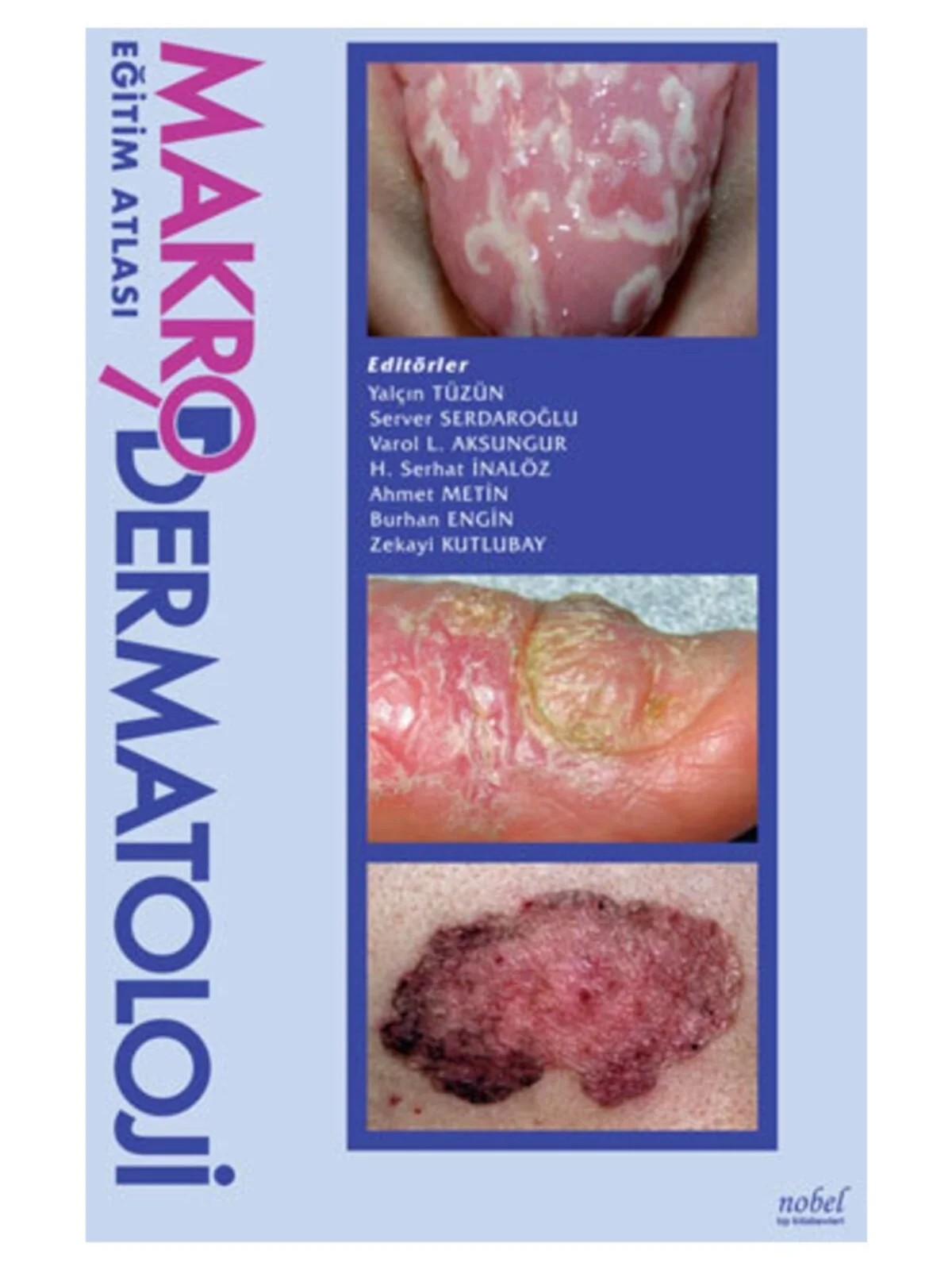 Makro Dermatoloji Eğitim Atlası – - – Nobel Tıp Kitabevleri kitap kapağı