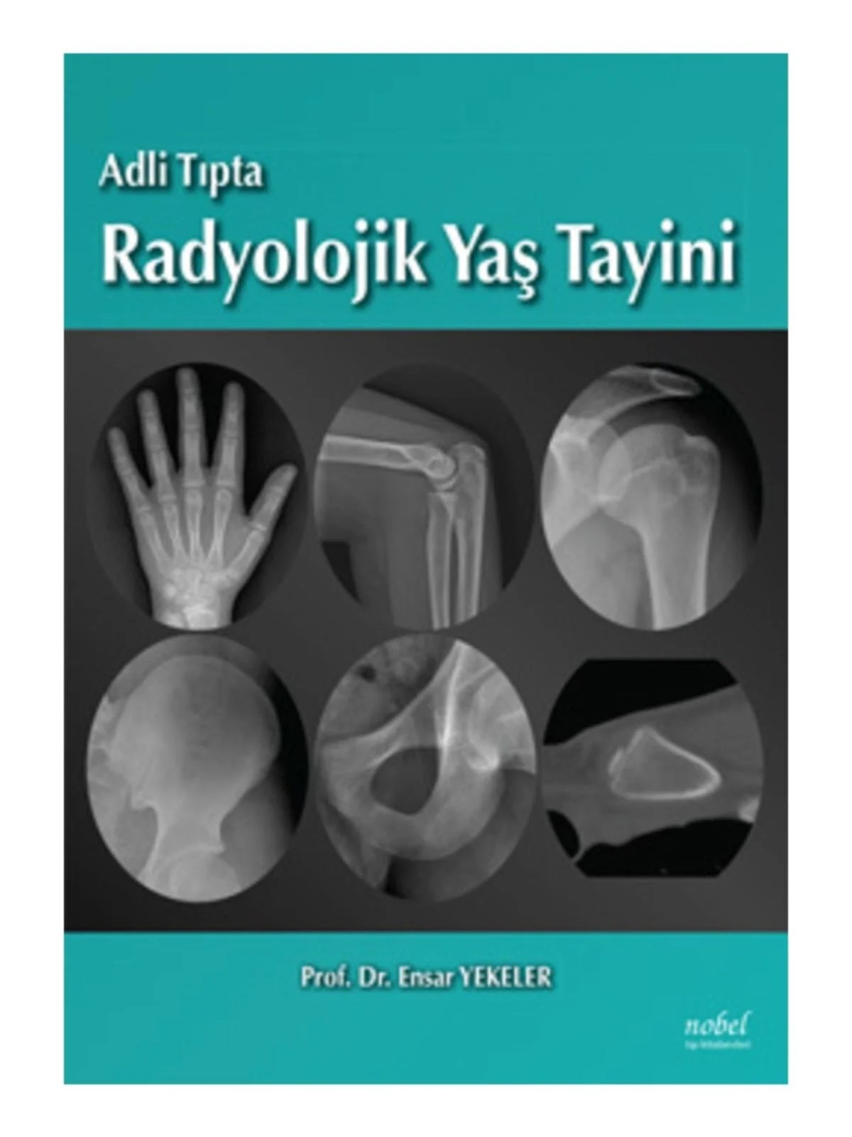 Adli Tıpta Radyolojik Yaş Tayini – Prof. Dr. Ensar Yekeler – Nobel Tıp Kitabevleri kitap kapağı