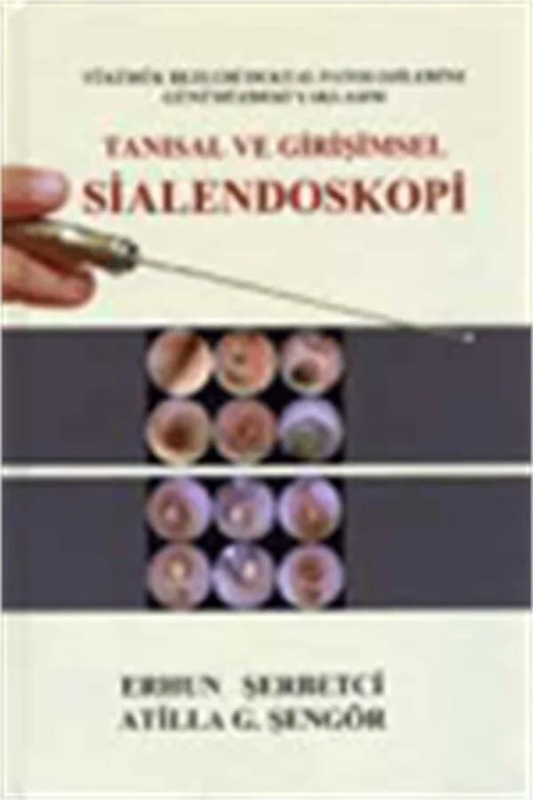Tanısal ve Girişimsel Sialendoskopi – Doç. Dr. Erhun Şerbetçi – Nobel Tıp Kitabevleri kitap kapağı