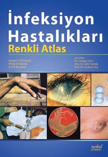 İnfeksiyon Hastalıkları: Renkli Atlas – Emond,  , Welsby, Rowland – Nobel Tıp Kitabevleri kitap kapağı